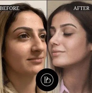 PRP Treatments in Dubai: Minimal Downtime, Maximum Results